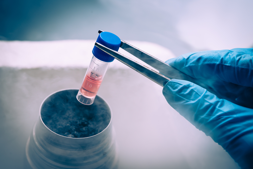 stem-cells