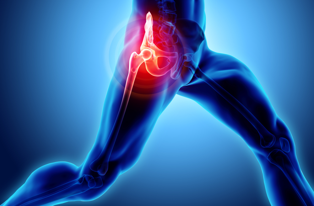 Hip Pain