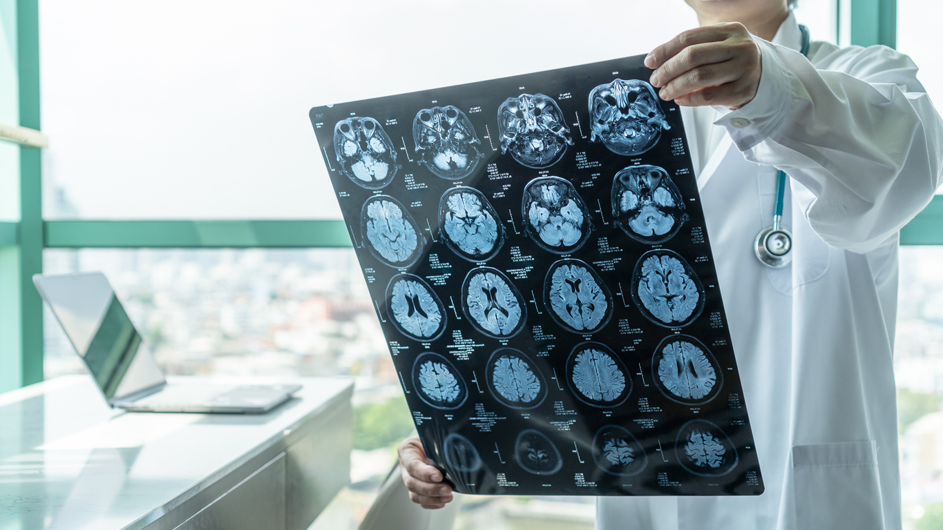 doctor holding x ray brain central nervous system