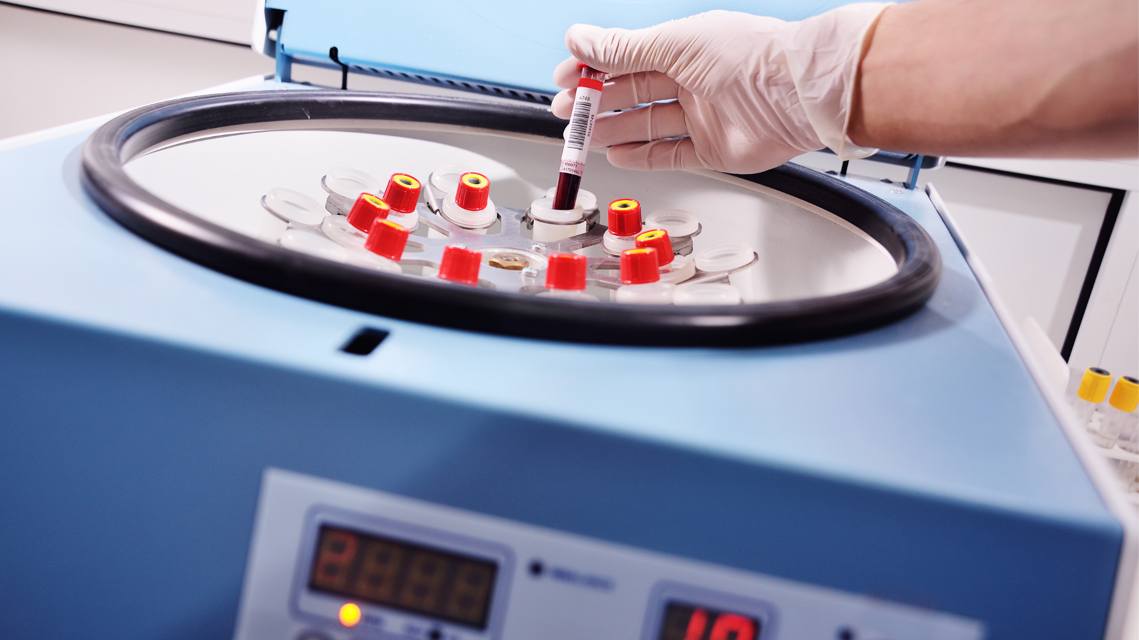 cellular treatments vials in centrifuge