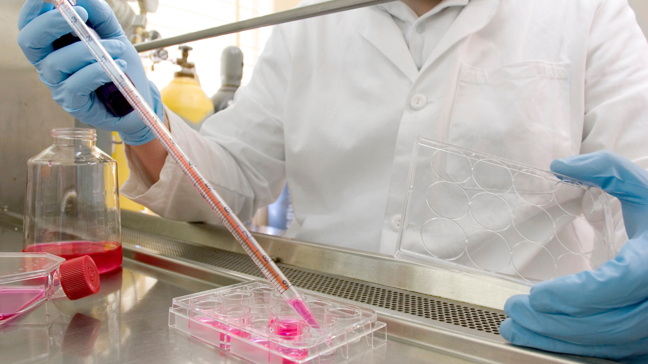 cellular therapy for neurological pain