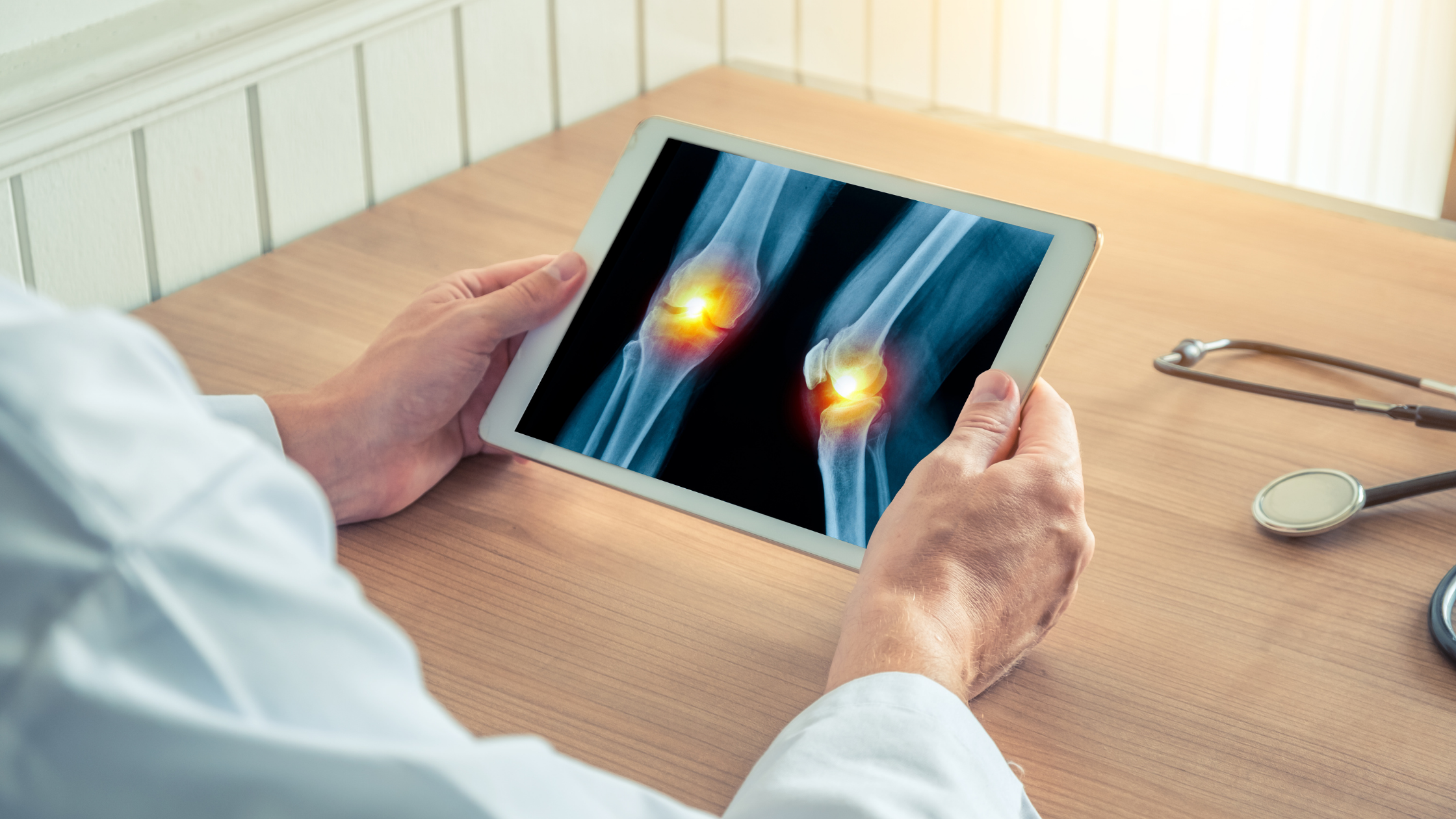 osteoarthritis in the knee