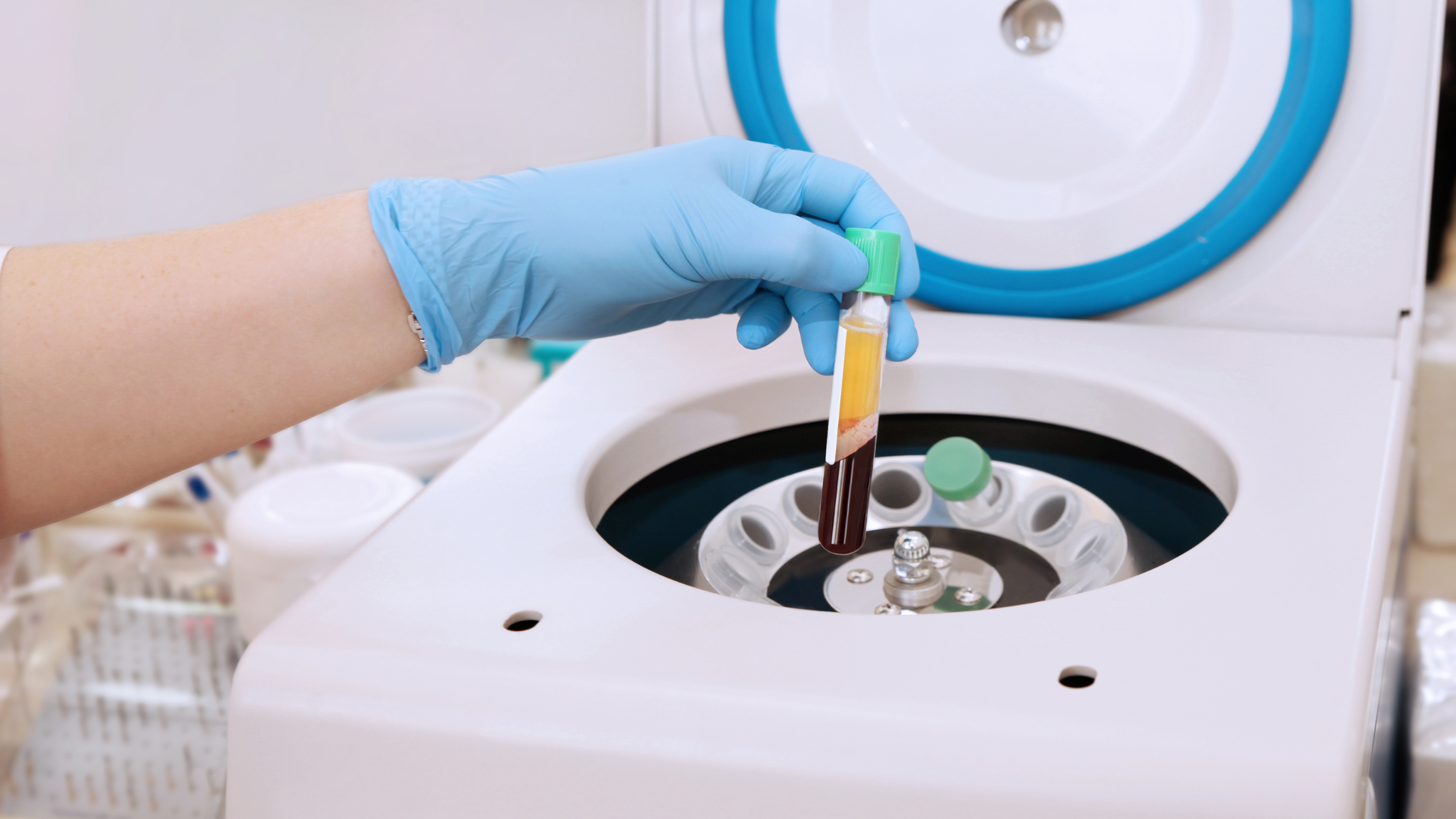 PRP Therapy vials in centrifuge